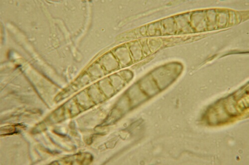 macrostoma