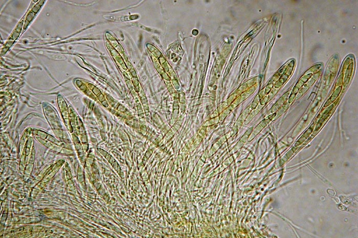 macrostoma