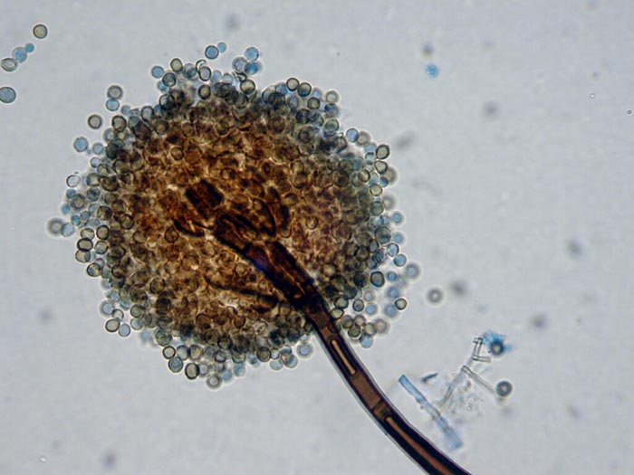 macrostoma