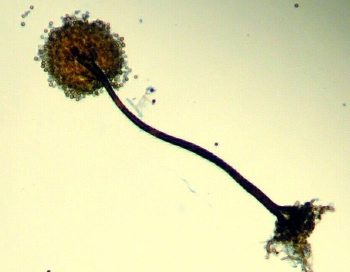 macrostoma
