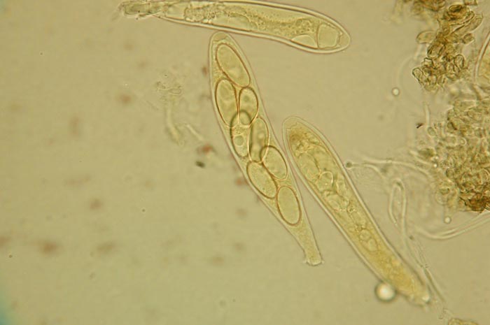 macrostoma