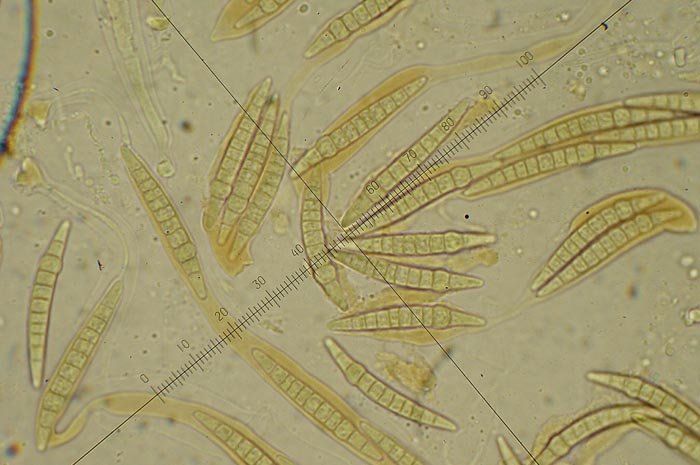 macrostoma