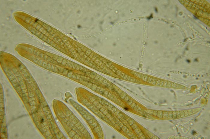 macrostoma