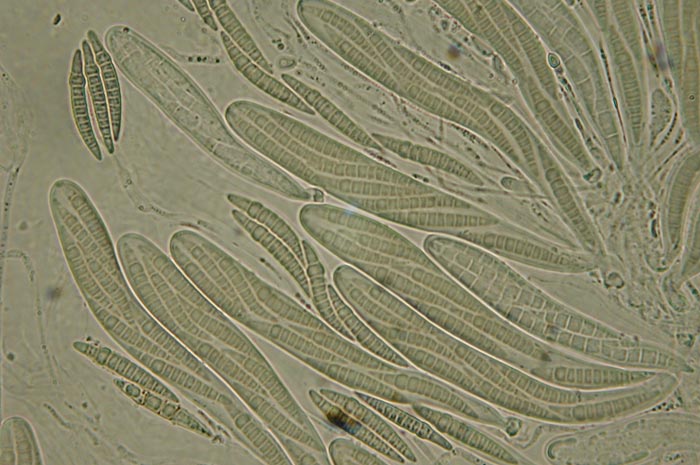 macrostoma