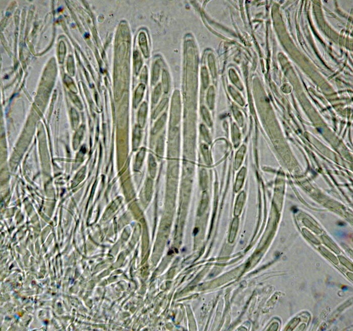 macrostoma