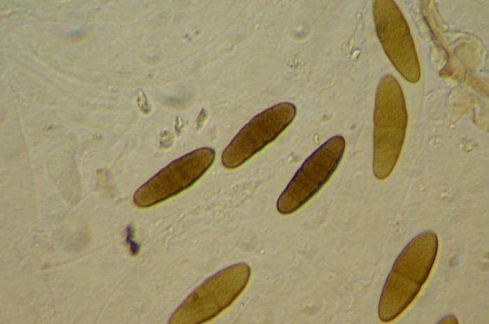 macrostoma