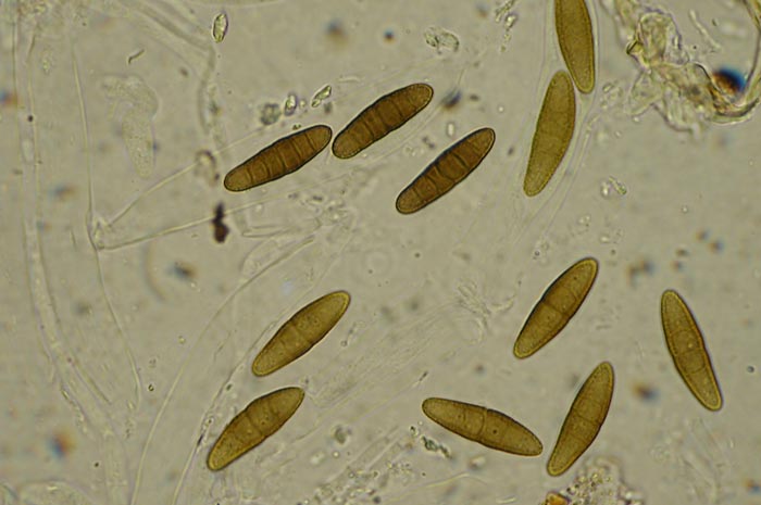 macrostoma