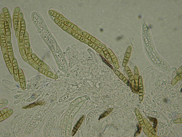 macrostoma