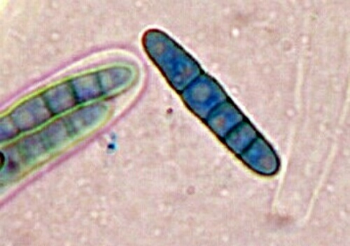 macrostoma