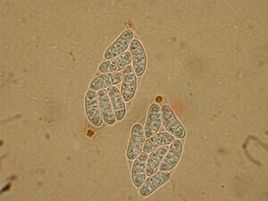 macrostoma