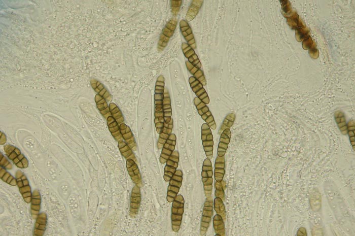 macrostoma