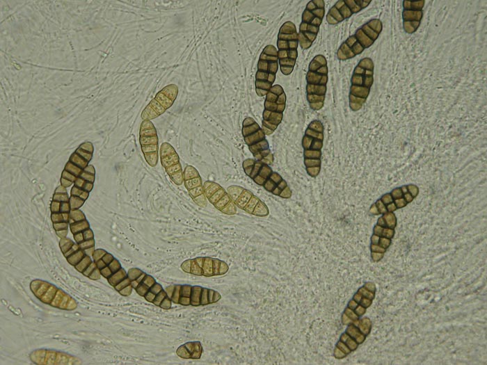 macrostoma