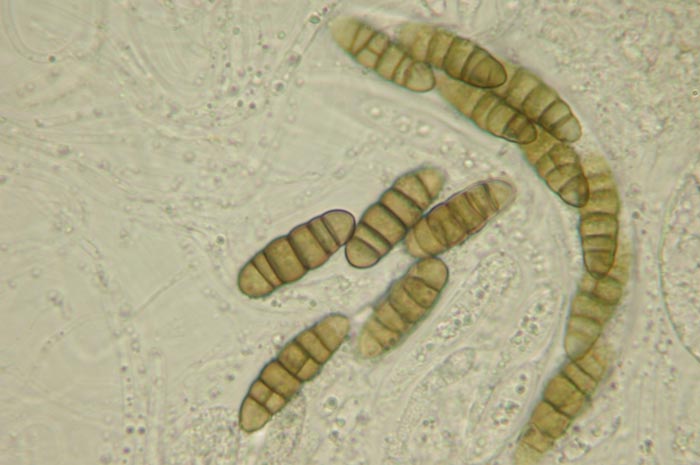macrostoma