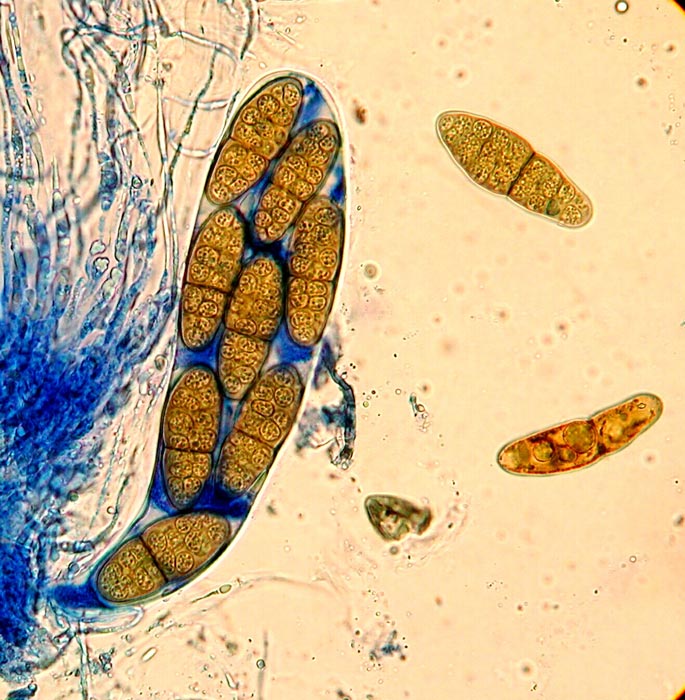macrostoma