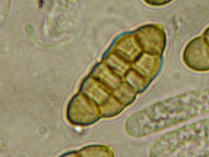 macrostoma