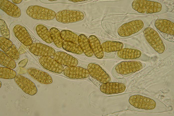 macrostoma