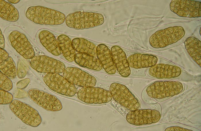 macrostoma