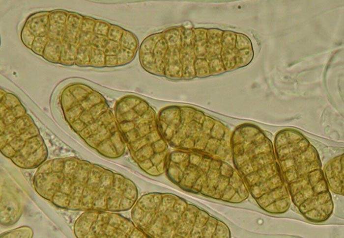 macrostoma