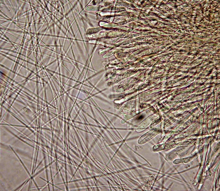 macrostoma