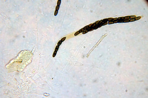 macrostoma