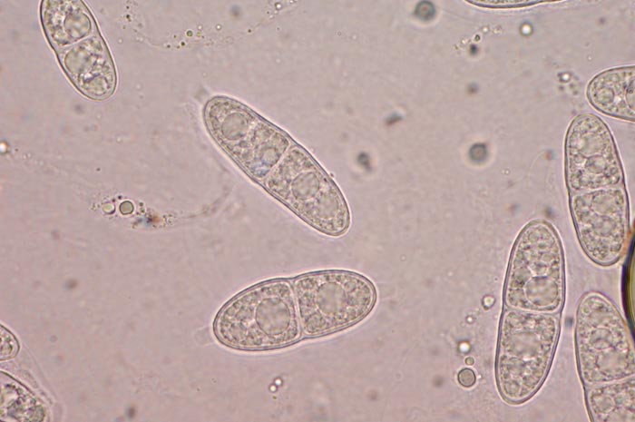 macrostoma
