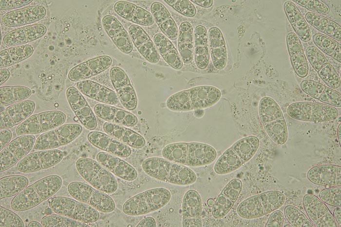macrostoma