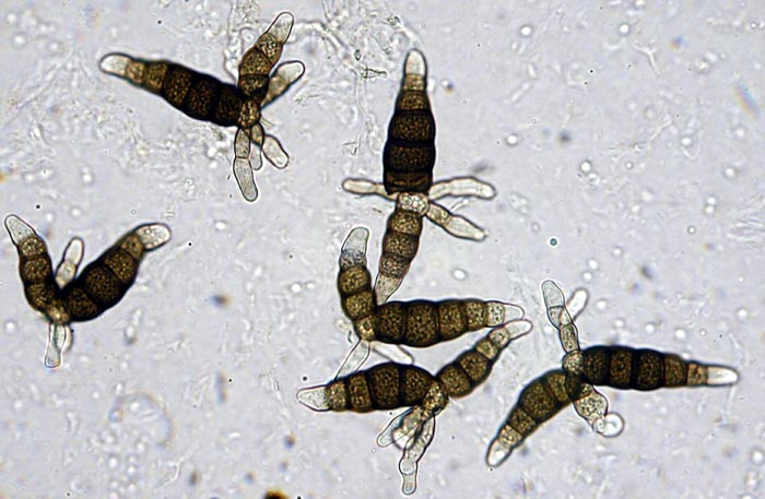macrostoma