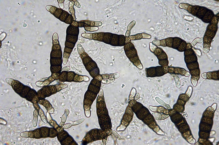 macrostoma