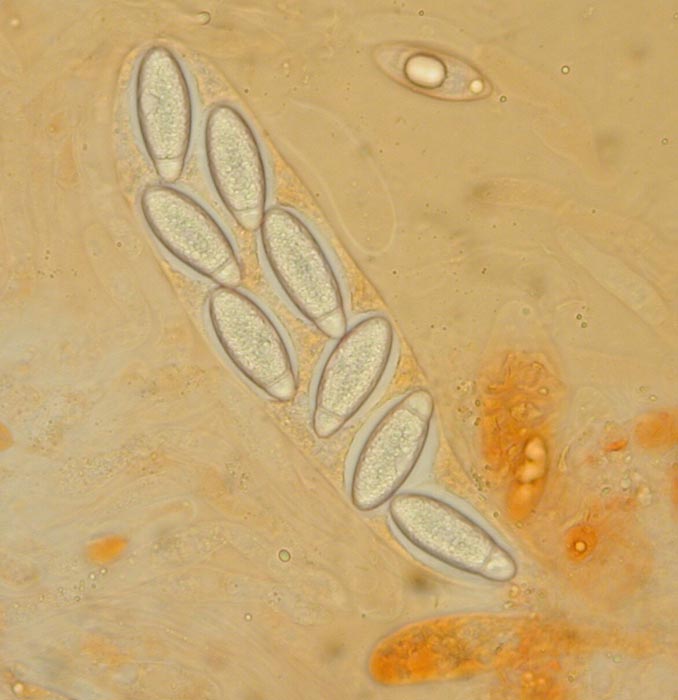 macrostoma