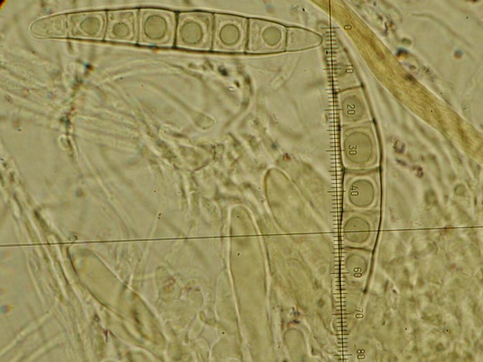 macrostoma