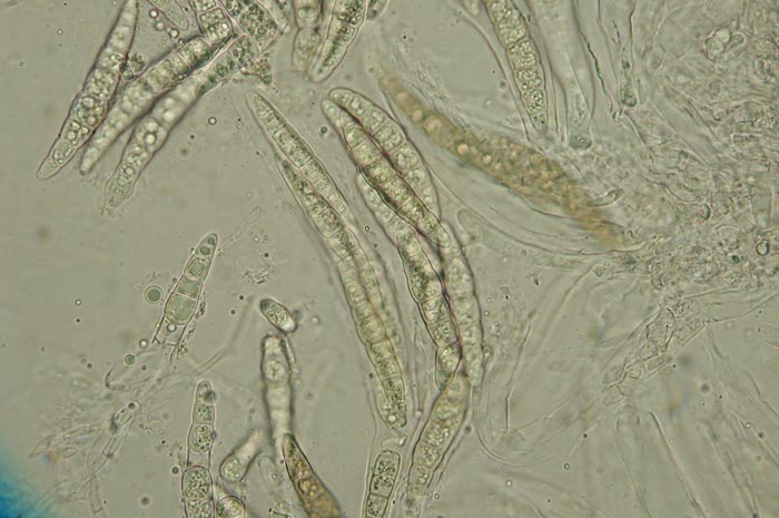 macrostoma