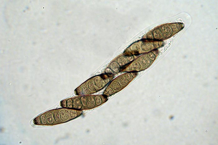 macrostoma