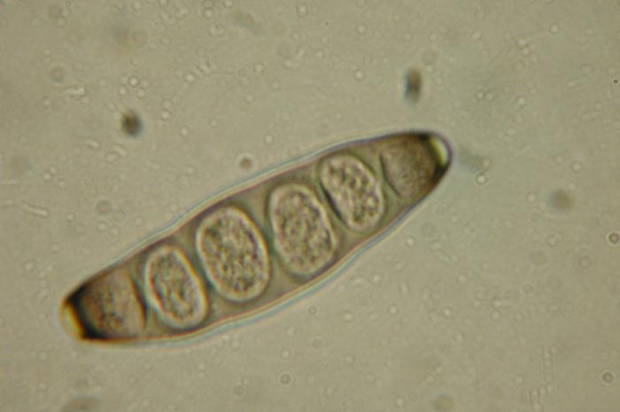 macrostoma