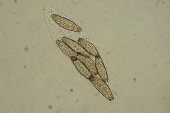 macrostoma