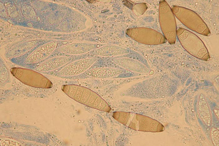 macrostoma