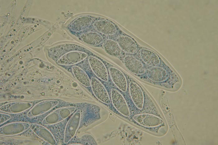 macrostoma