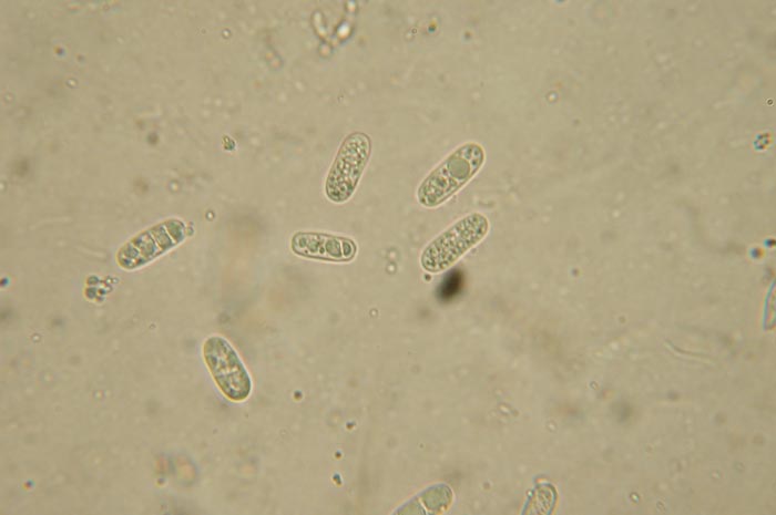 macrostoma