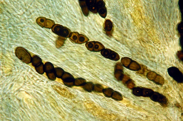 macrostoma