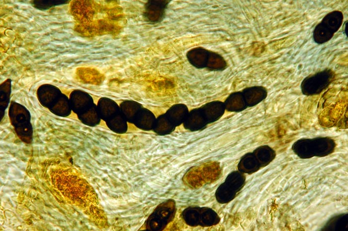 macrostoma