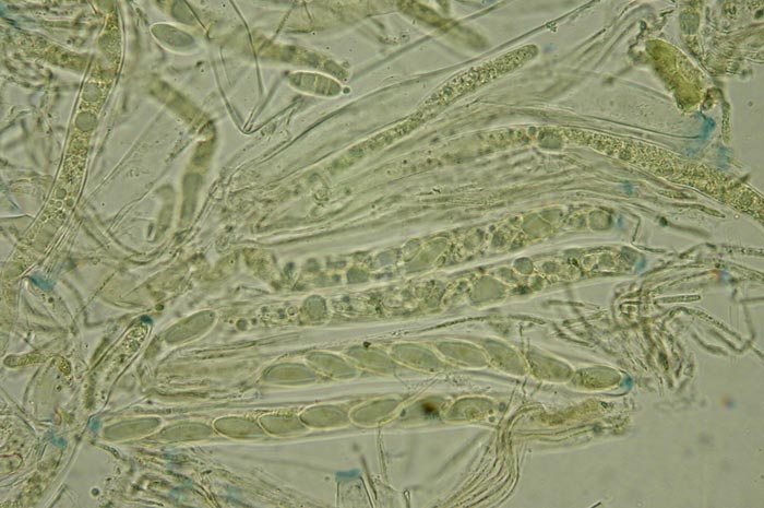 macrostoma