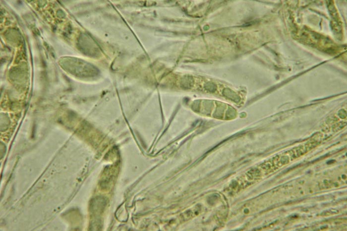 macrostoma