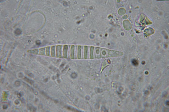macrostoma