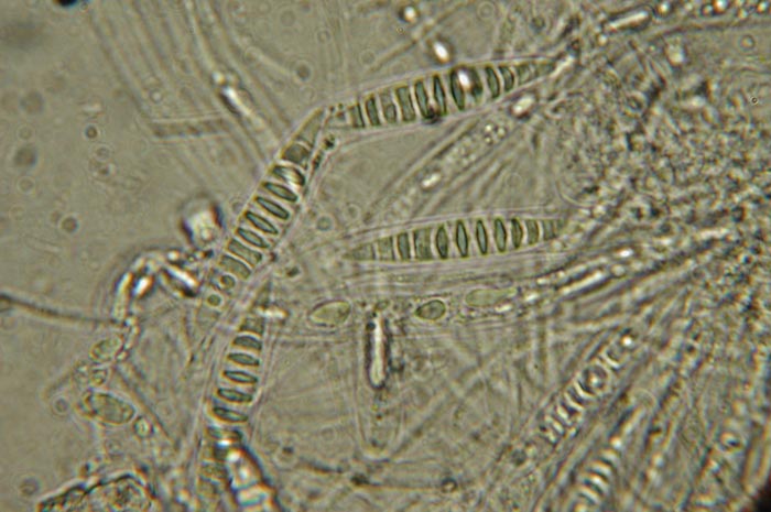 macrostoma