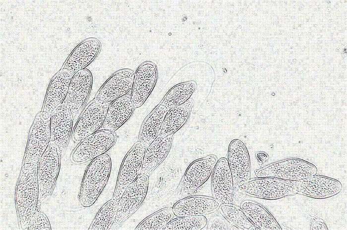 macrostoma
