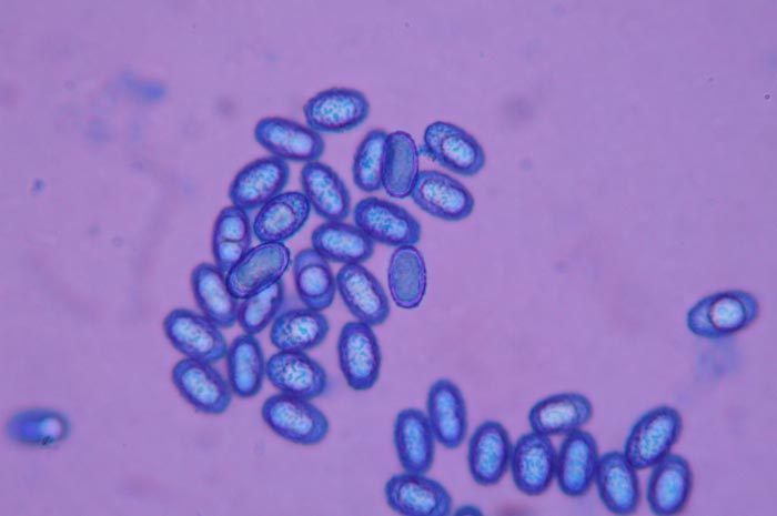 macrostoma