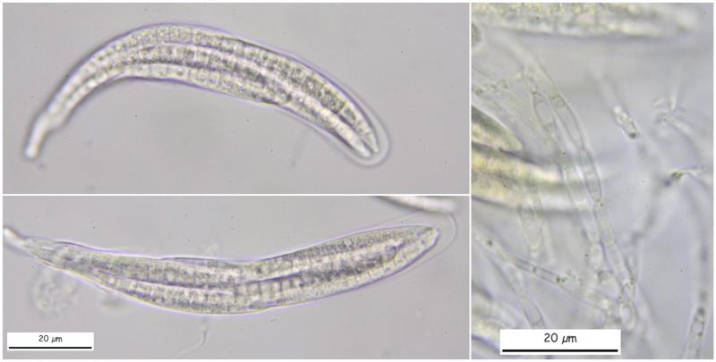 macrostoma