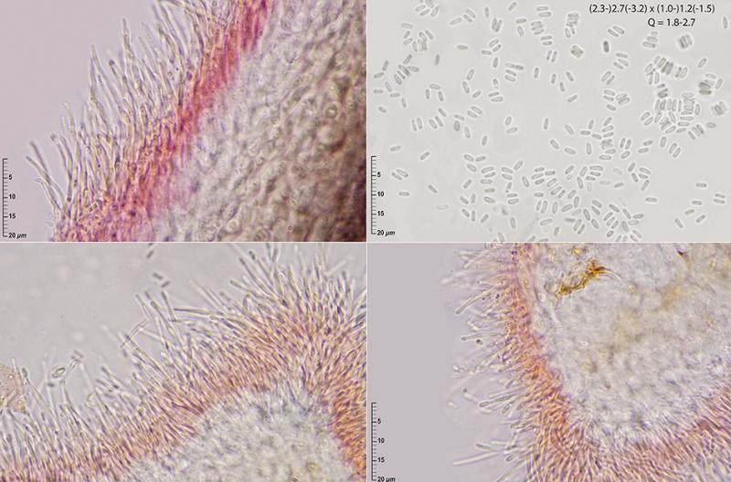 macrostoma
