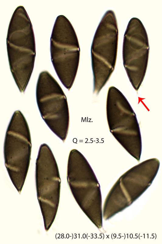 macrostoma