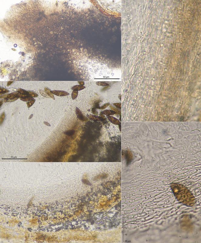 macrostoma