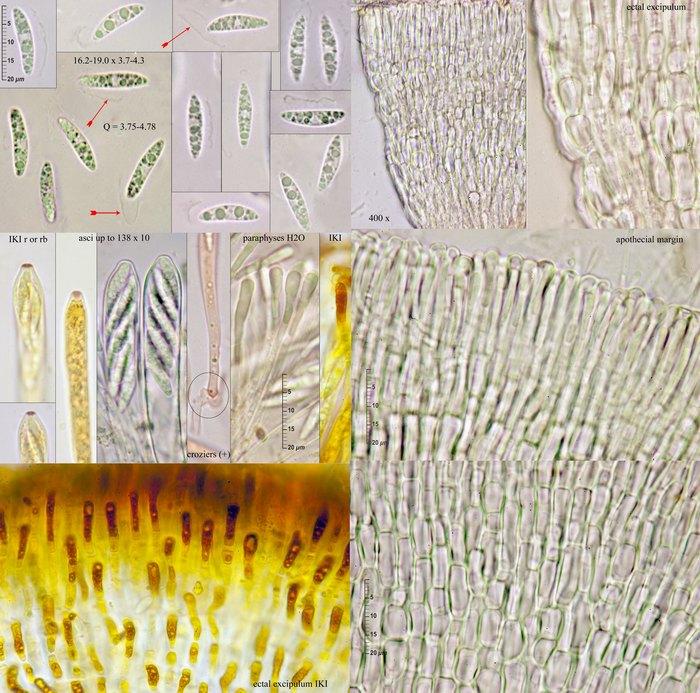 macrostoma